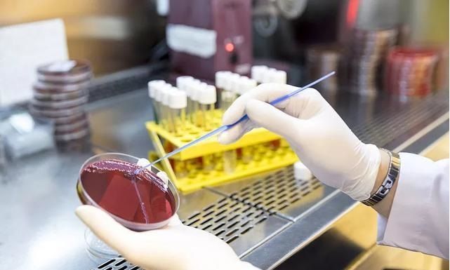 ABUIABACGAAgqPfdkwYomJqonwQwgQU4gQM